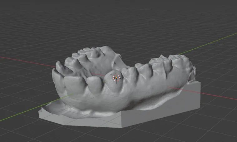Digital 3D scan of a lower dental arch used to design a custom mouthguard